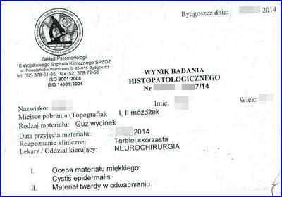 Badanie histopatologiczne guza mózgu