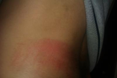 Wypadek w pracy na kopalni